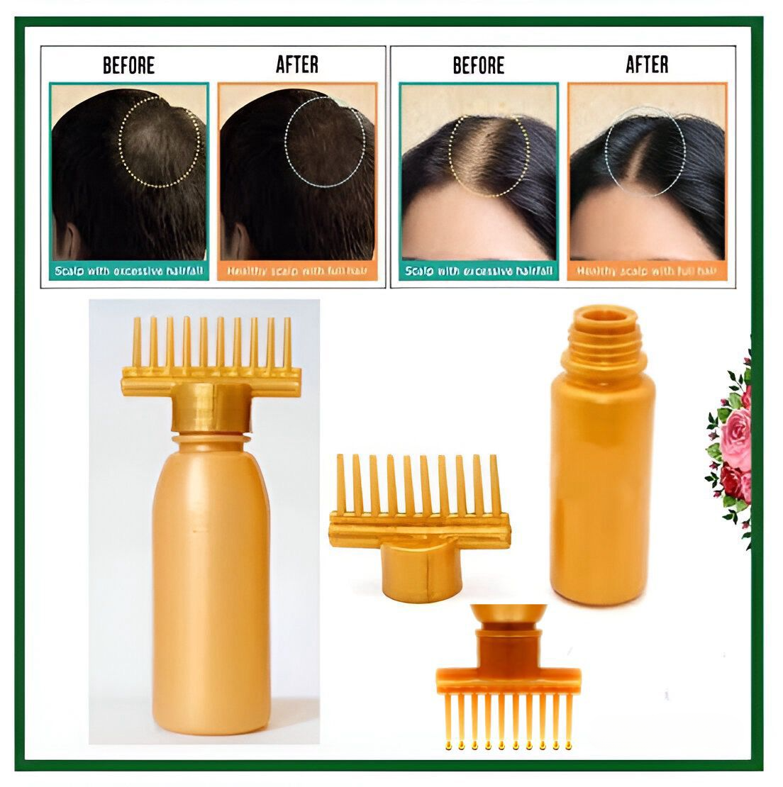 (Pack of 20) Hair dye bottle | Hair Oil Applicator Bottle, Root oiling Comb bottle for Hair Coloring, Shampoo, Oiling, Dye, and Scalp Treatment for home & commercial ( Empty Bottle)