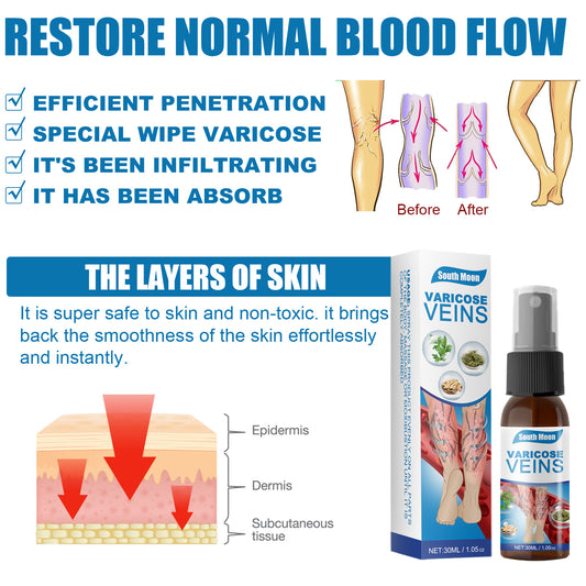 30ml Varicose Veins Treatment Spray Varicose Vein Treatment Cream Repair Varicocele Removal Pain Relief Kidney Inflammation Legs Vein Health Care Spray