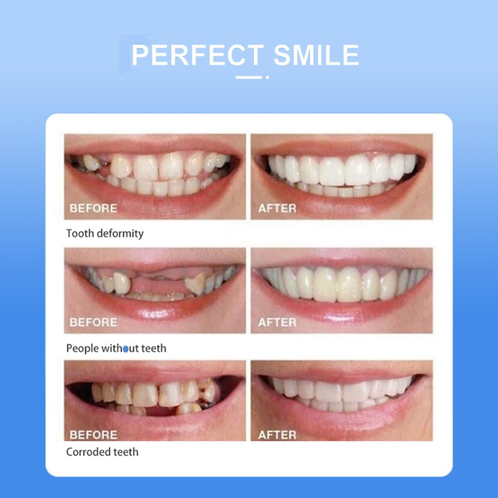 Snap-On smile for Beautiful Smiles Temporary Comfort Fit Whitening Instant Transformation for Men &amp; Women